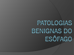 Patologias Benignas do Esôfago