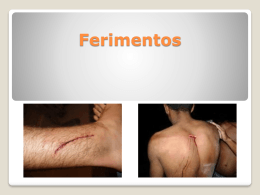 Ferimentos - Prof. Ingrid