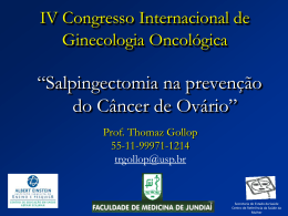 Salpingectomia na prevenção do Câncer de ovário