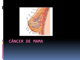 N2Cancer de Mama