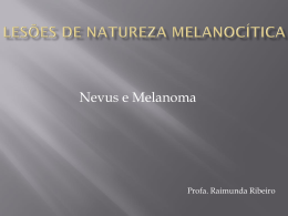 Lesões de natureza Melanocítica Nevus e Melanoma 1