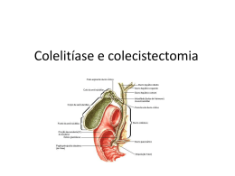Colelitíase e colecistectomia