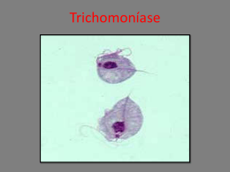 Trichomoníase