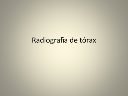 Radiografia de tórax