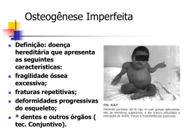 Osteogênese Imperfeita