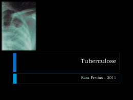 T2 – Tuberculose