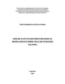 acr&iacute;lica sobre