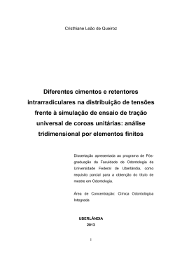 Diferentes cimentos e retentores intrarradiculares na