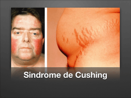 sindrome de cushing apres