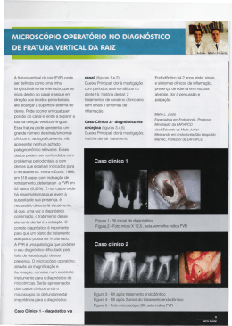 Caso Clinico 1 - diagn6stico via Endodontico ha 2