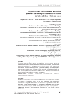 Diagn&oacute;stico do defeito &oacute;sseo de stafne por meio de