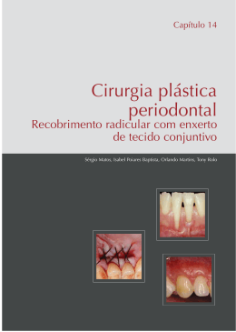 Cirurgia plástica periodontal - Clínica de Medicina Dentária de