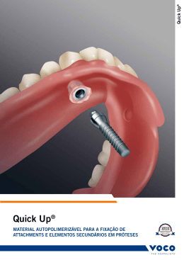 Quick up&reg;