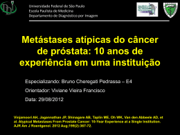 metástases atípicas do câncer de próstata - (DDI)