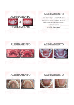 ALINHAMENTO & NIVELAMENTO ALINHAMENTO