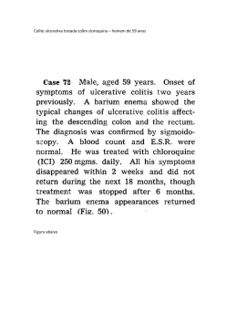 Colite ulcerativa tratada co0m cloroquina – homem de 59 anos