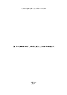 falhas biomec&acirc;nicas das pr&oacute;teses sobre implantes