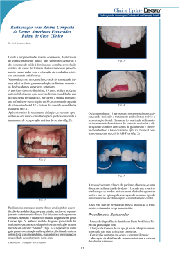 Restaura&ccedil;&atilde;o com Resina Composta de Dentes