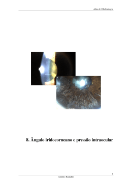 AO-8. &Acirc;ngulo Iridocorneano