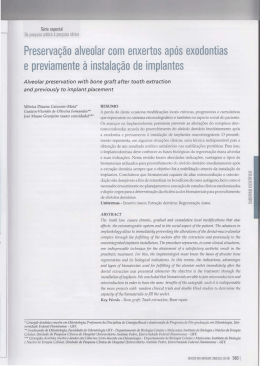 Preserva&ccedil;&atilde;o alveolar com enxertos ap&oacute;s exedentias