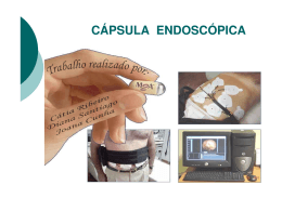 Capsula Endoscopica