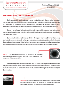 Implante - HI - Bionnovation
