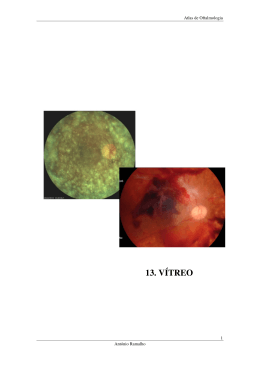 13. V&Iacute;TREO - Ant&oacute;nio Ramalho