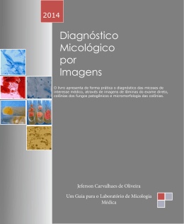 Diagnóstico Micológico por Imagens