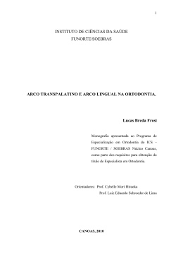 Arco Lingual e Arco Transpalatino na Ortodontia
