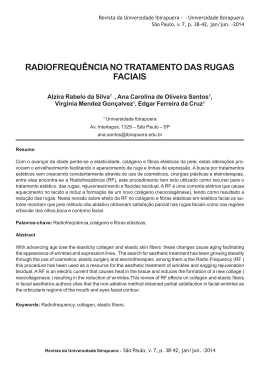 4. Radiofrequência no tratamento das rugas