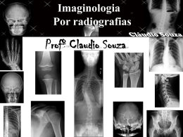 SOUZA, Claudio. Imaginologia por Radiografias da - e