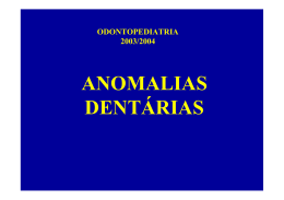 Anomalias Dentárias em Odontopediatria